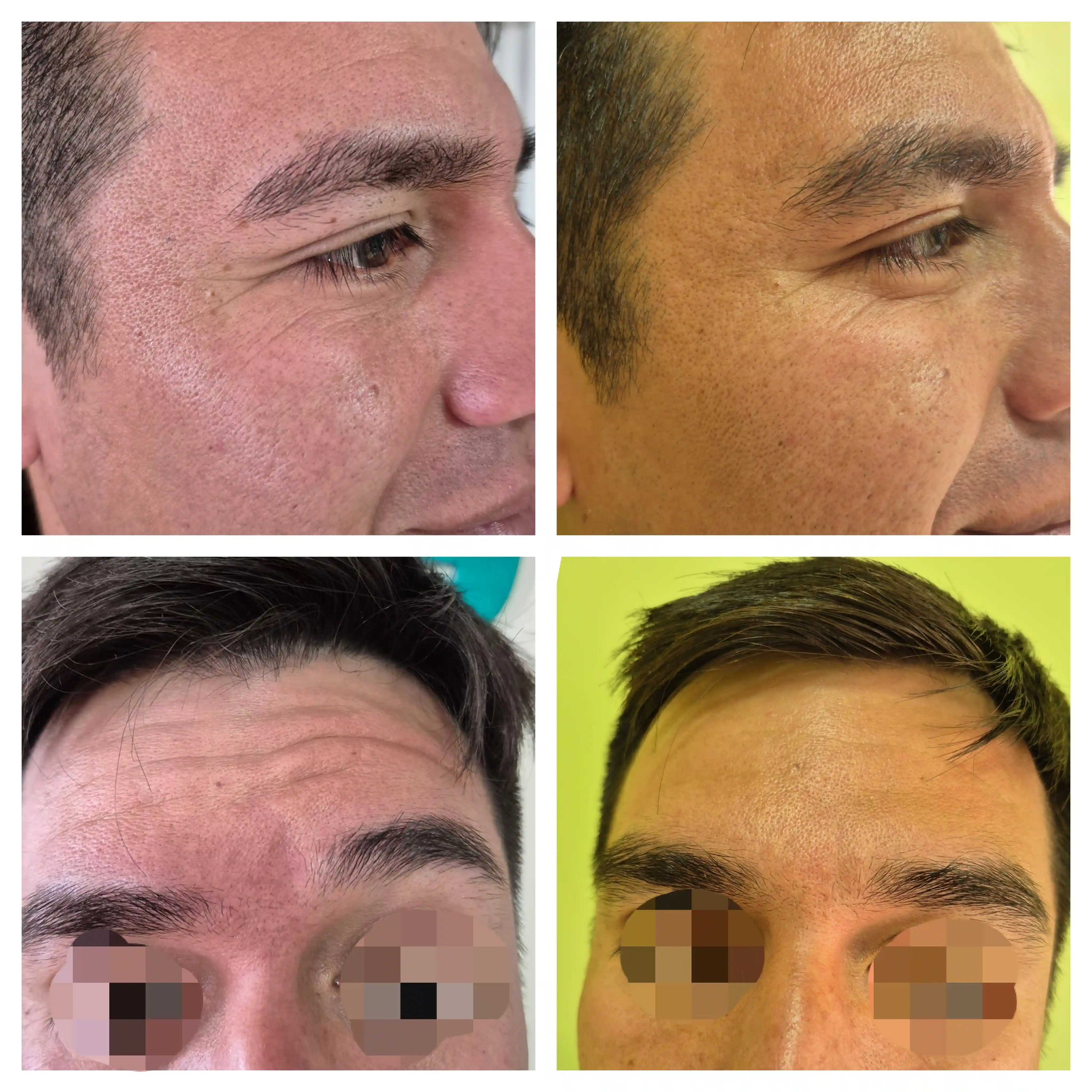 CheckVital Clínica Estética La Serena