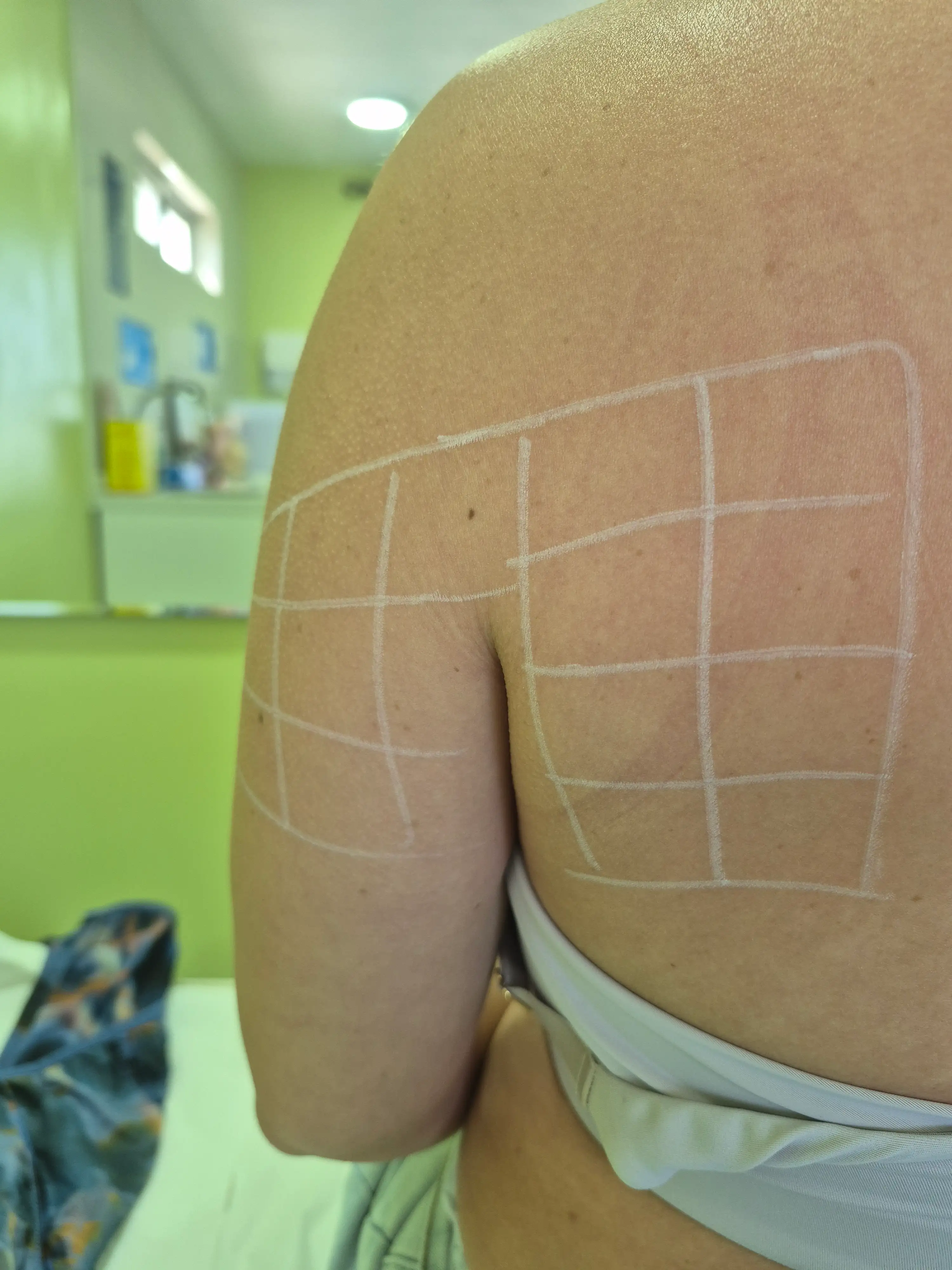 Cómo actúa Lipolax en la grasa localizada