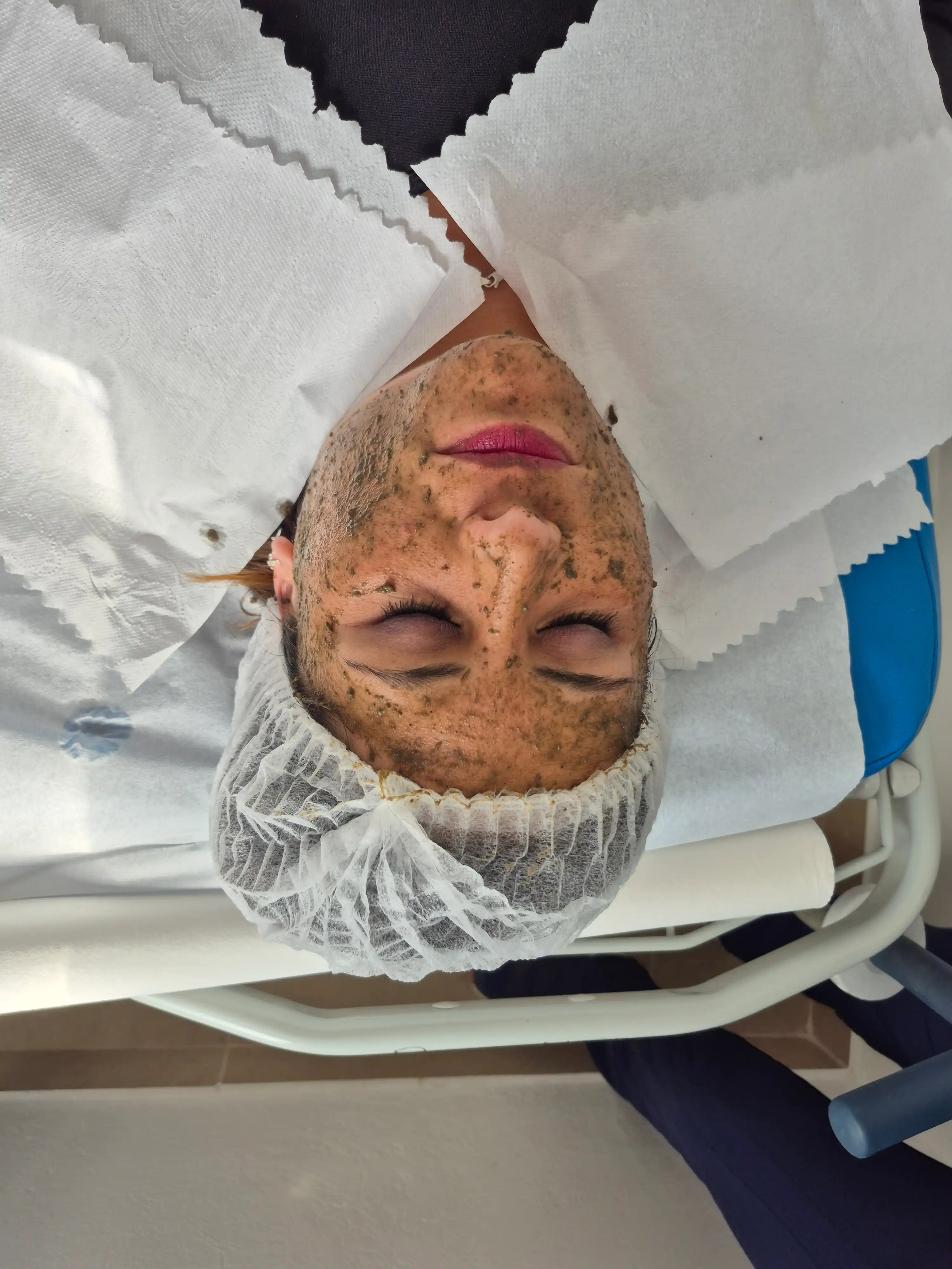 Peeling de algas proceso