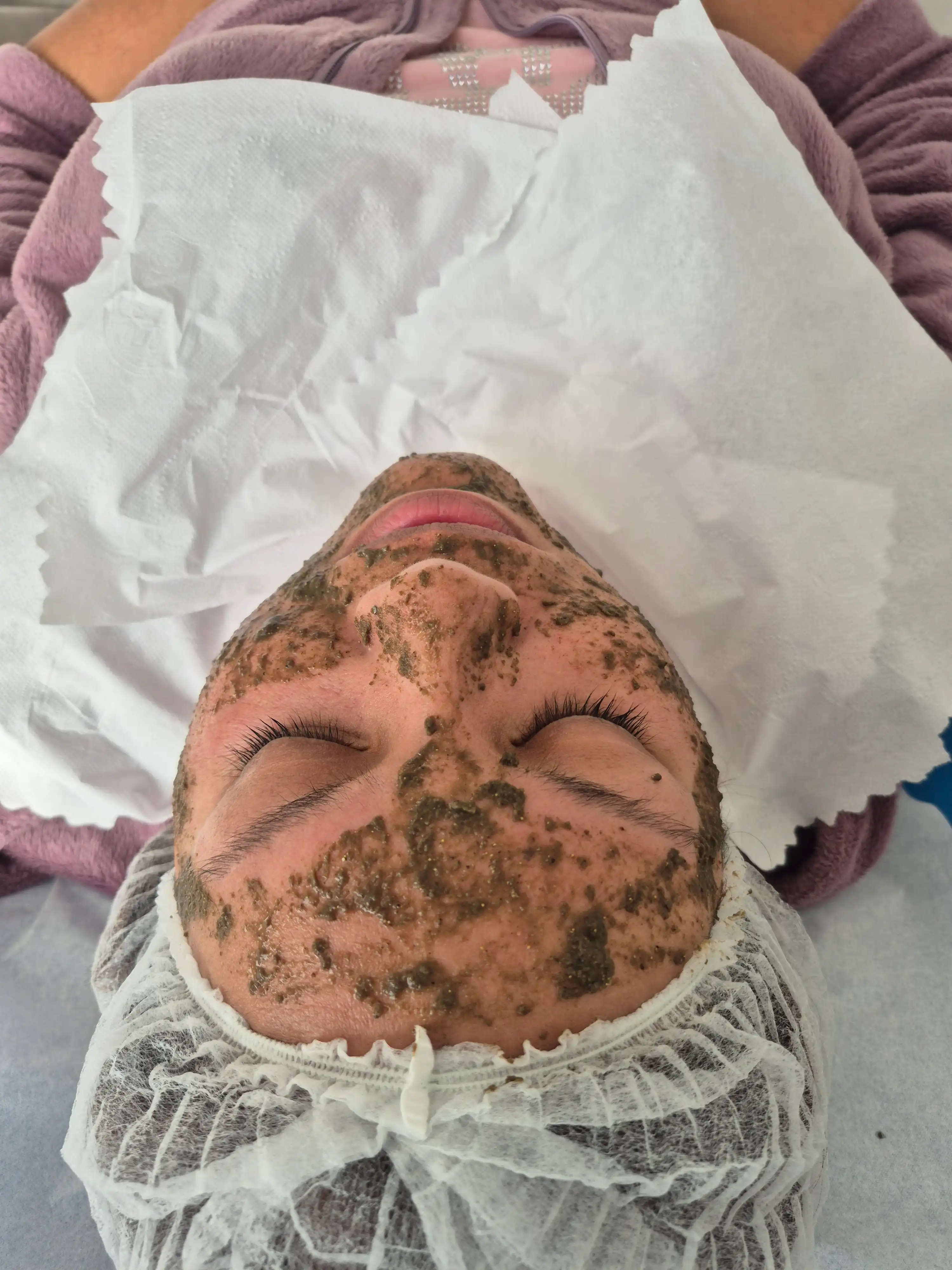 Resultados del peeling de algas