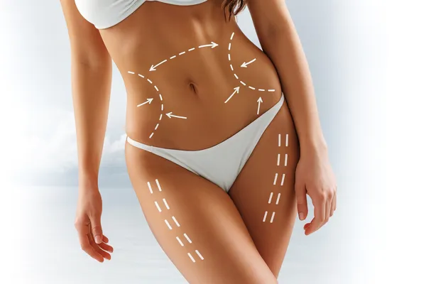Mesoterapia con Silicio Orgánico | Reafirma y regenera tu piel