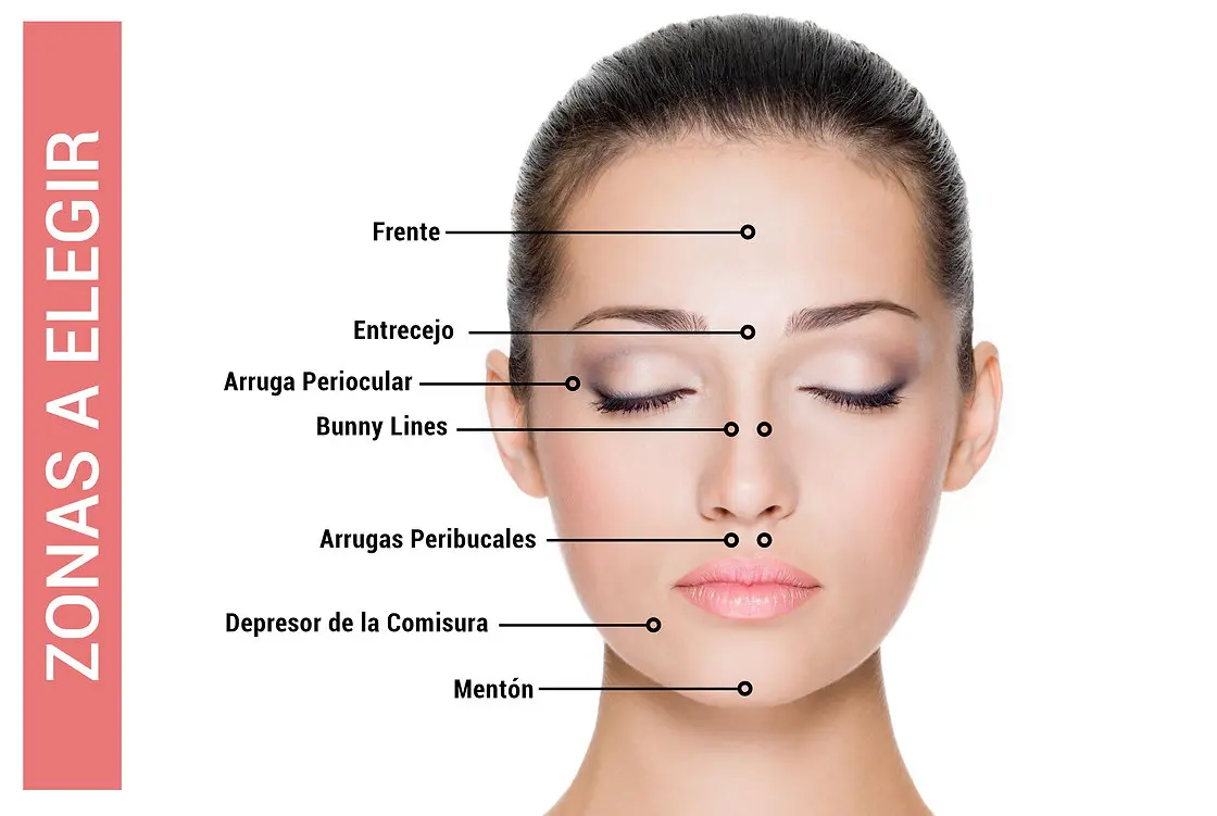 Aplicación del tratamiento con Botox en CheckVital